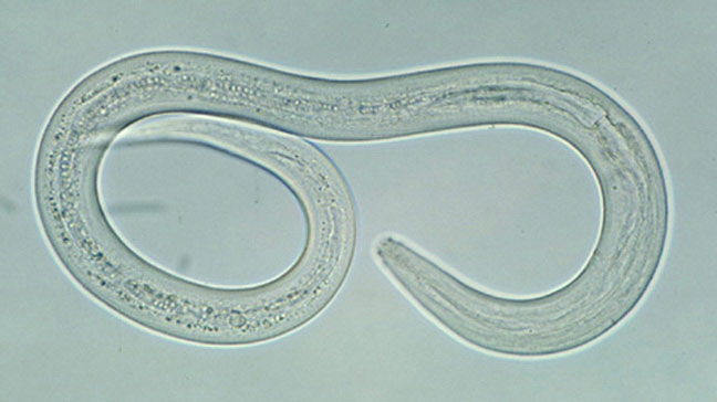 Hookworm Infections Causes Symptoms And Treatments